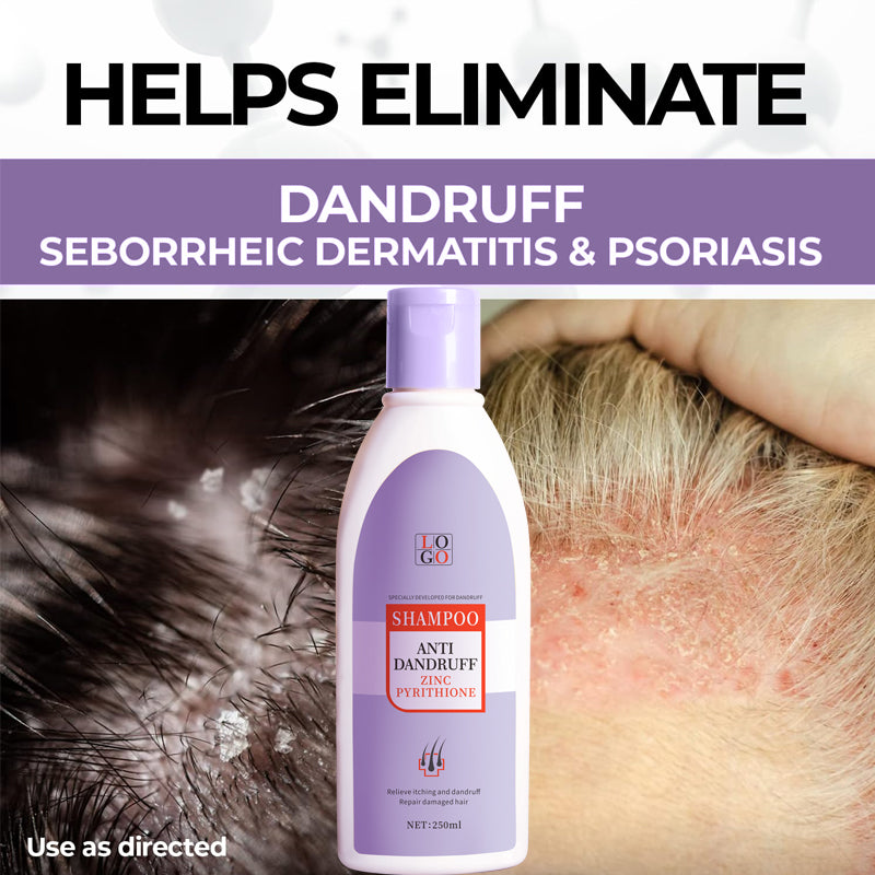 Pabrik pengolahan sampo anti-ketombe zinc pyrithione OEM